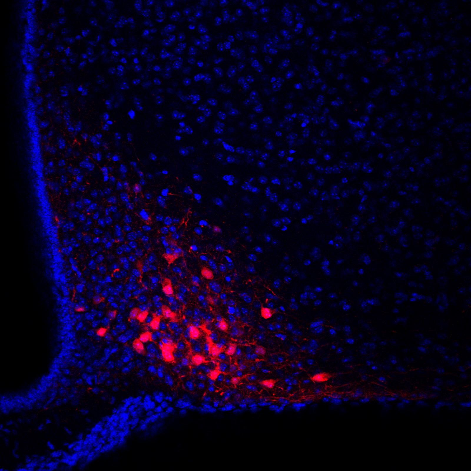 arc tdtomato dapi